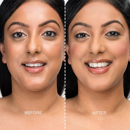 Before and after model